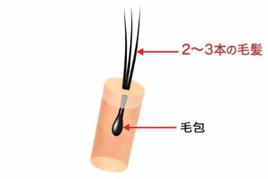 グラフトのイメージ