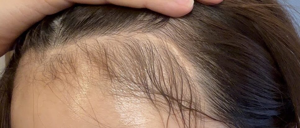 うぶ手の中にある傷跡