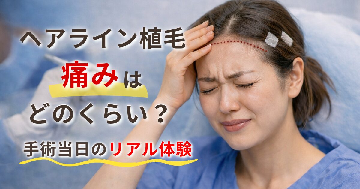 ヘアライン植毛の痛みはどれくらい？手術当日のリアル体験